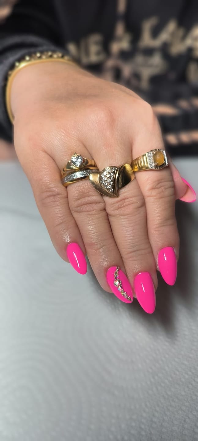 Customer photo review of The Golden Steel Wonder Ring Set