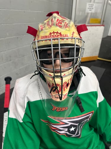 Customer photo review of Professional Vision Training Goggles  |  One Size Fits All