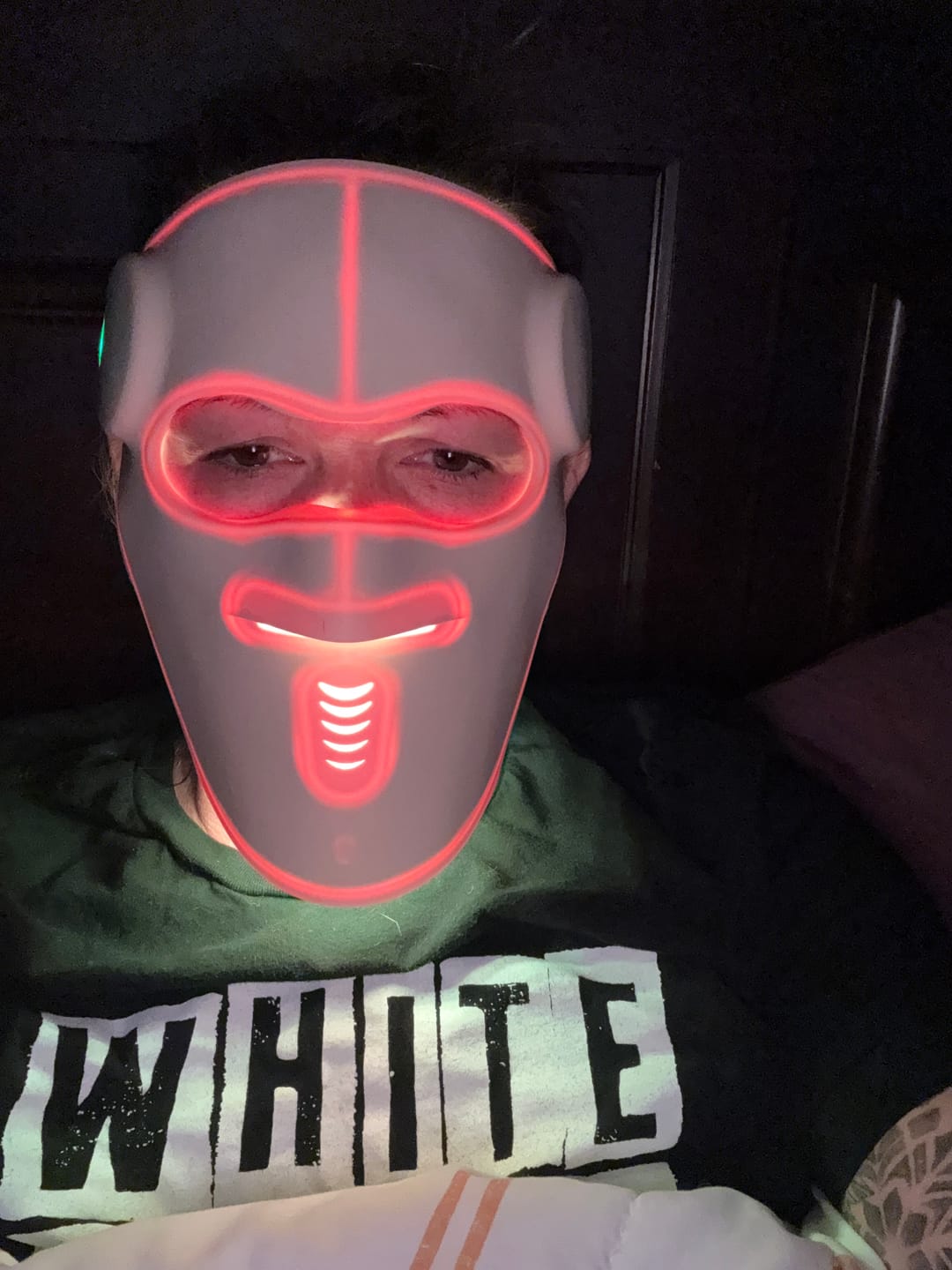 Customer photo review of Hatch Halo™ Dermatologist-Grade 3-in-1 Light Therapy Mask
