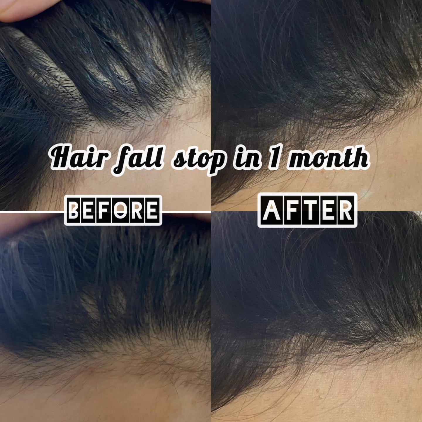 Customer photo review of Anagrow Hair Serum