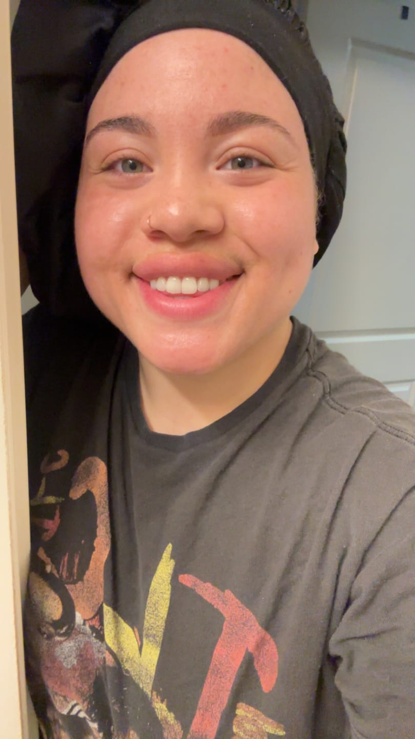 Customer photo review of Turmeric Brightening Soap (with Vitamin C, Alpha Arbutin, Oat)