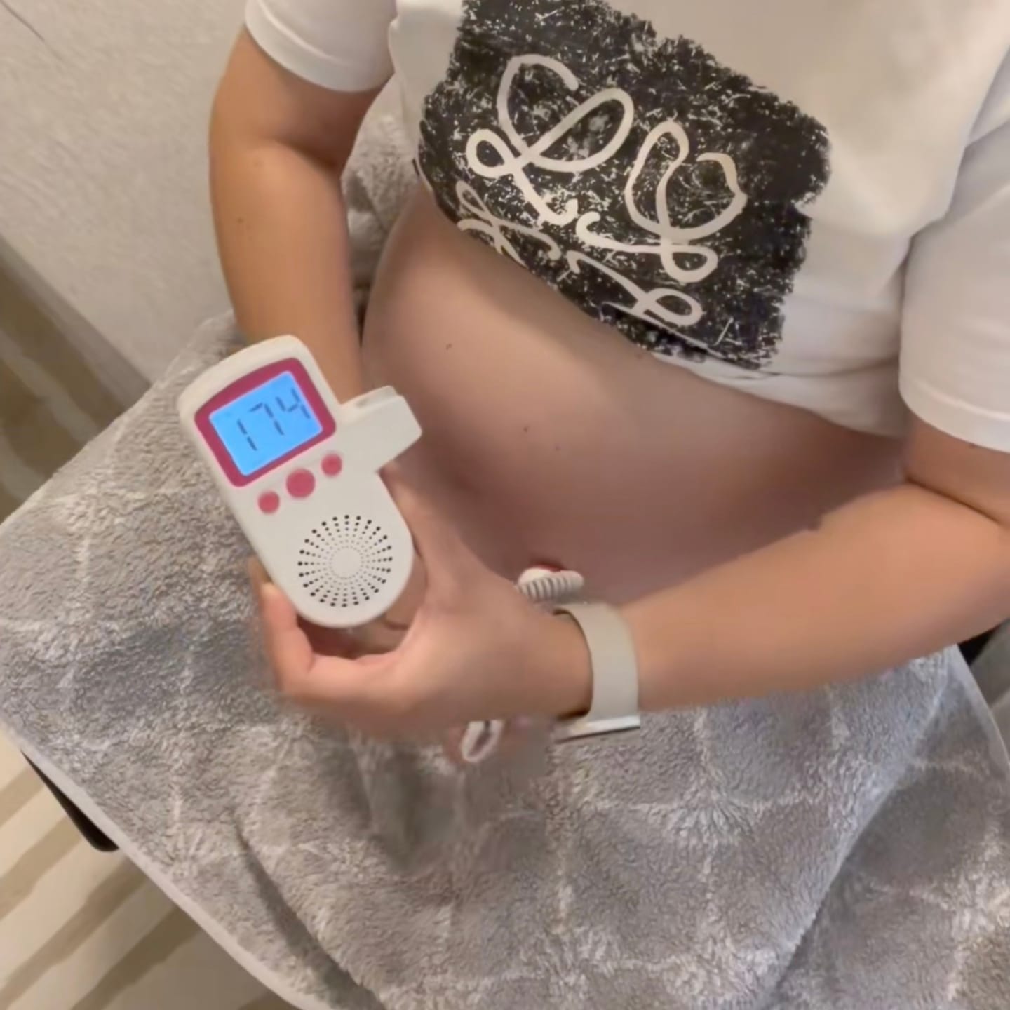 Customer photo review of BabyEcho Doppler™