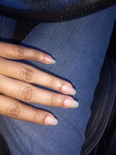 Customer photo review of Complex10™ Hair Growth Supplement