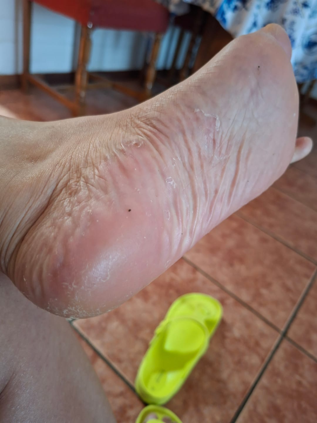 Customer photo review of Crema Pies Suaves Siempre – Urea 40%