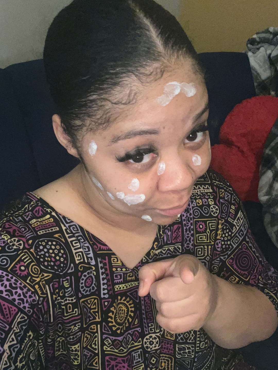 Customer photo review of Acne Drying Lotion Plus — 2 Pack (20 mL × 2)