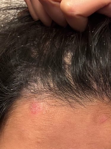 Customer photo review of Seb Natural Calming Serum