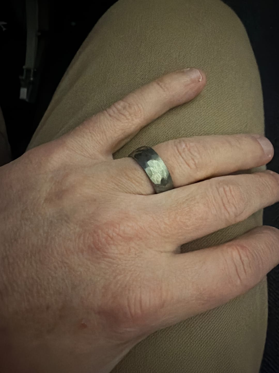 Customer photo review of Warrantied Ring Replacement