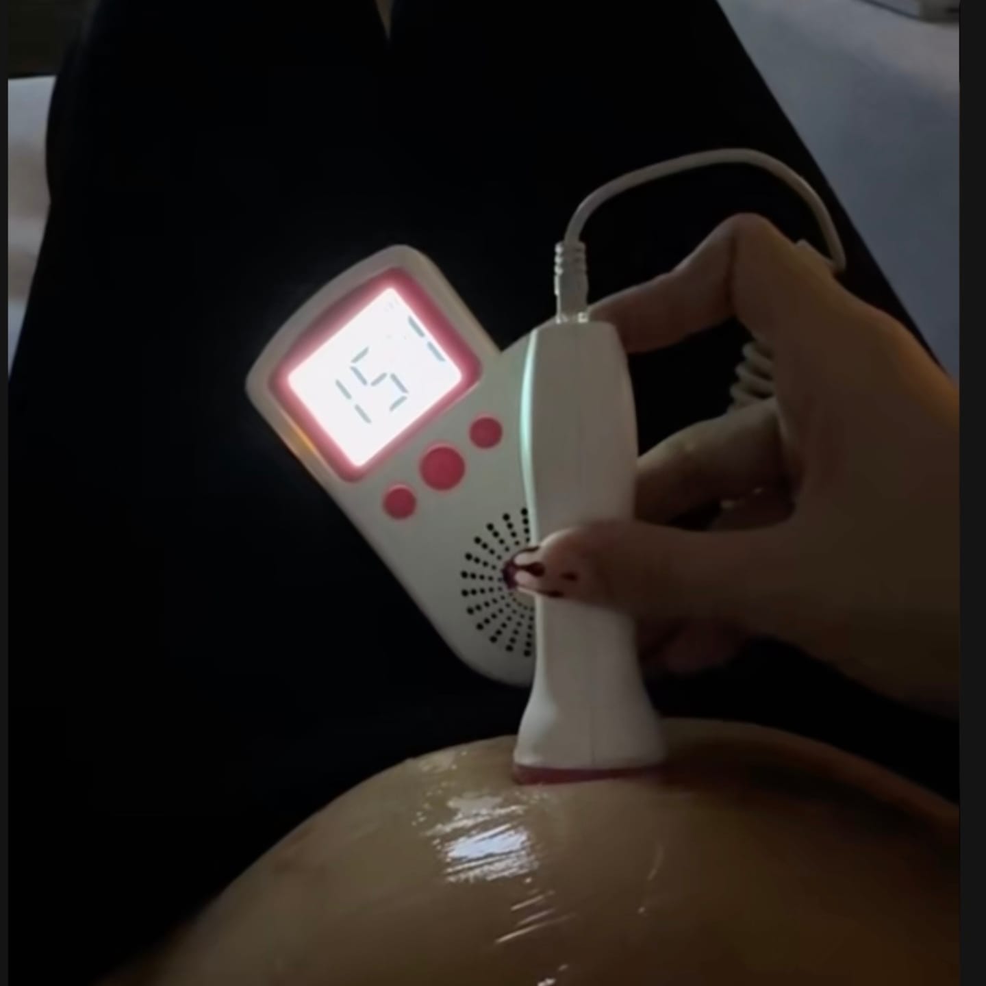 Customer photo review of BabyEcho Doppler™