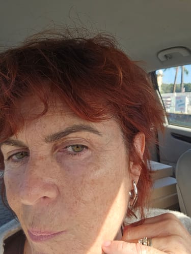 Customer photo review of Sérum de Exosomas Ultra Rejuvenecedor con Bioexosomas de Bakuchiol