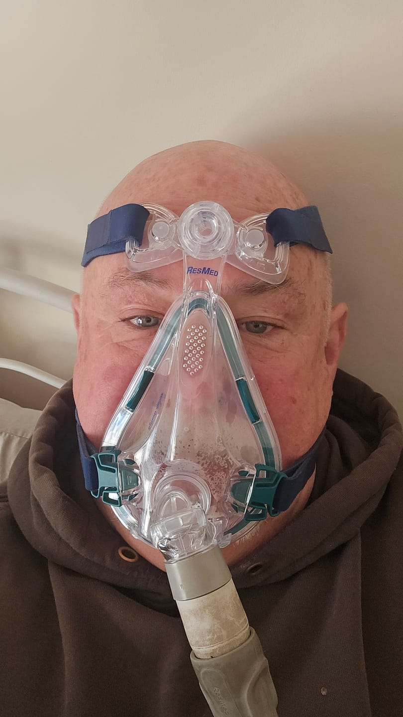 Customer photo review of ResMed Mirage Quattro Full Face Mask with Headgear