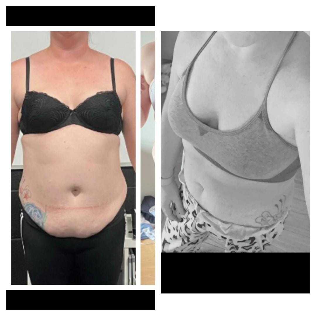 Customer photo review of Collagen Fat Burner | 150 Capsules