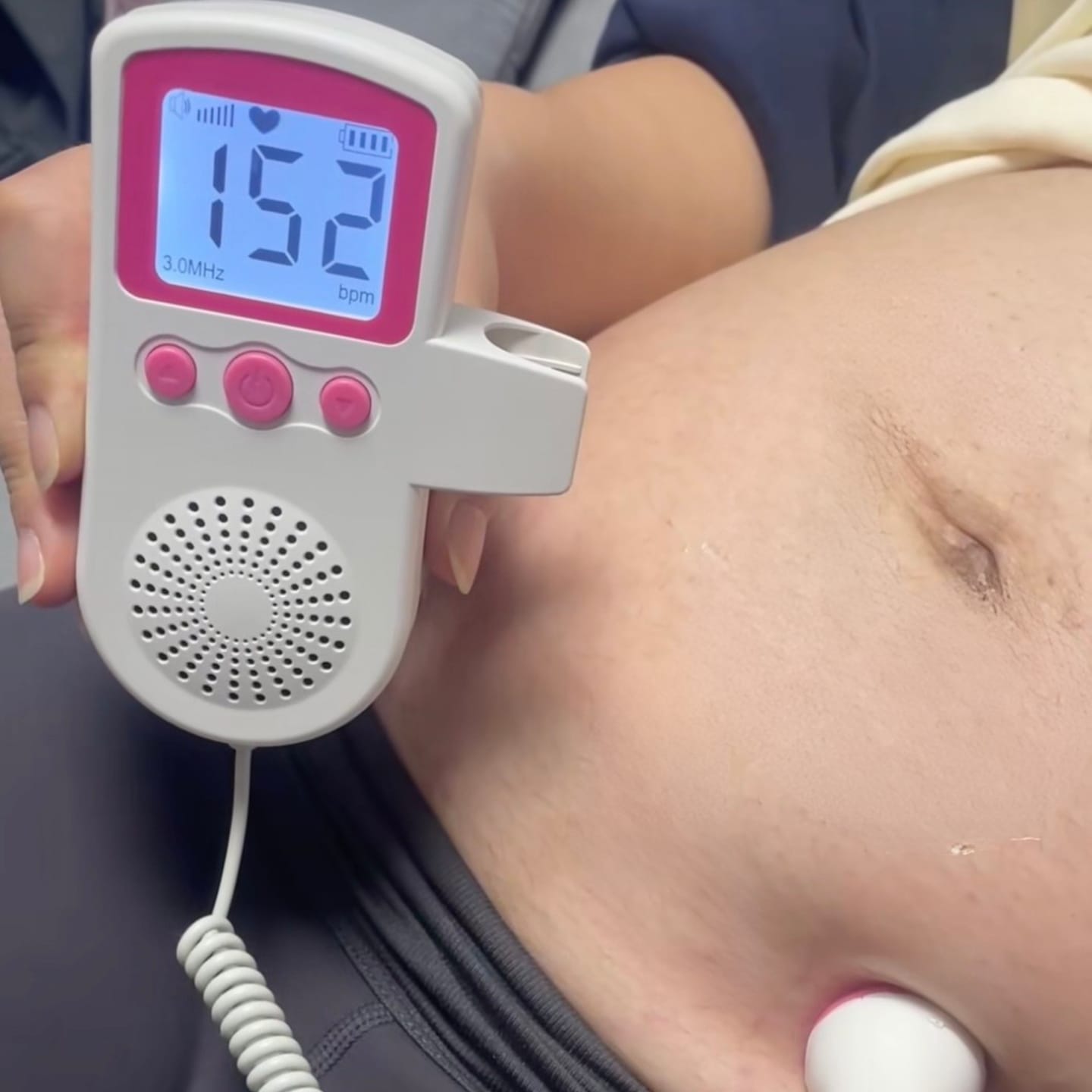 Customer photo review of BabyEcho Doppler™