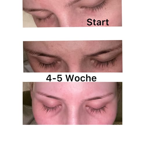 Customer photo review of LASHCOCA!NE PEPActive - Wimpernserum