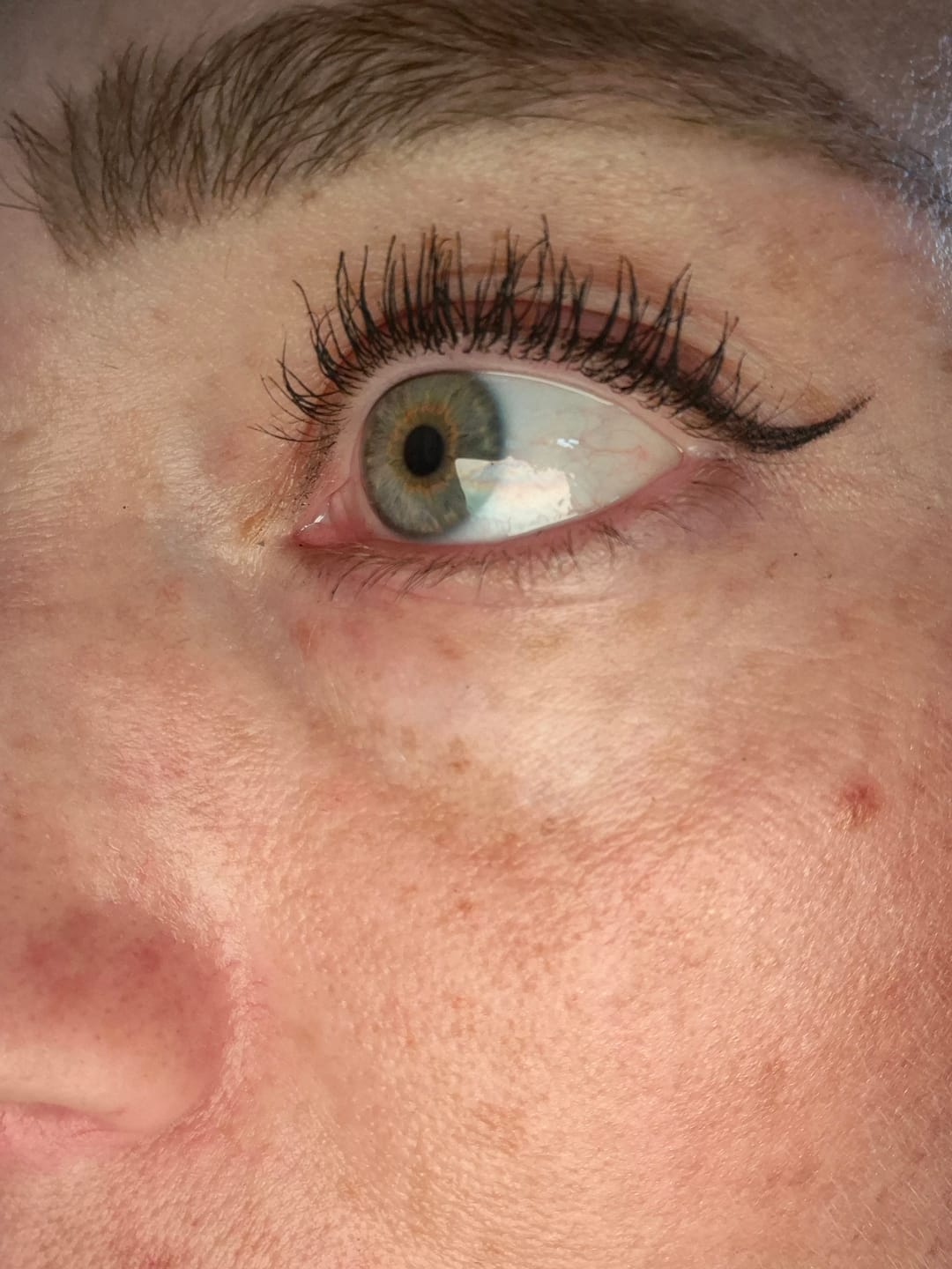 Customer photo review of Wimpernserum