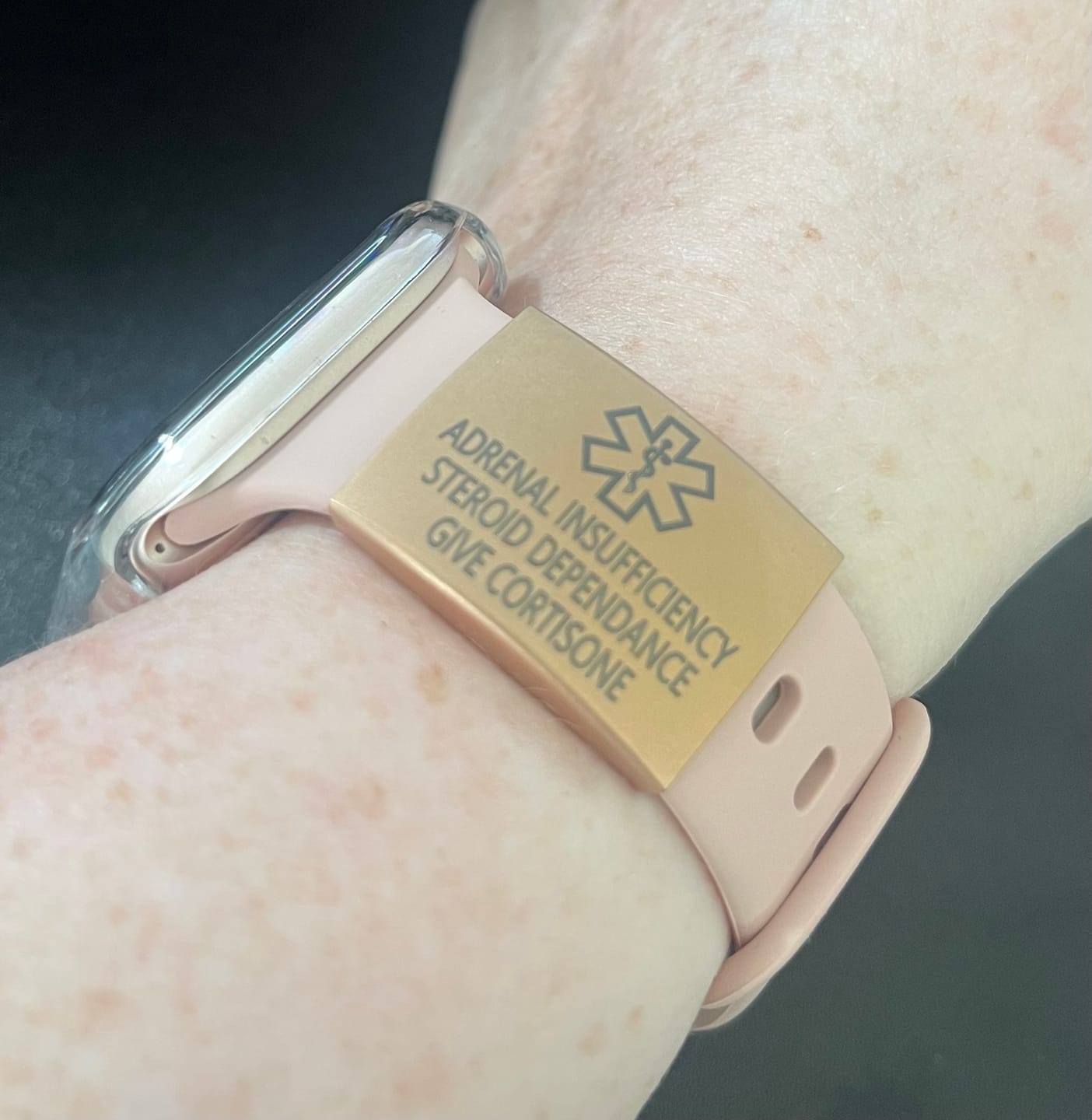 Customer photo review of Personalised ID Tag for Watch Band & Fitness Trackers