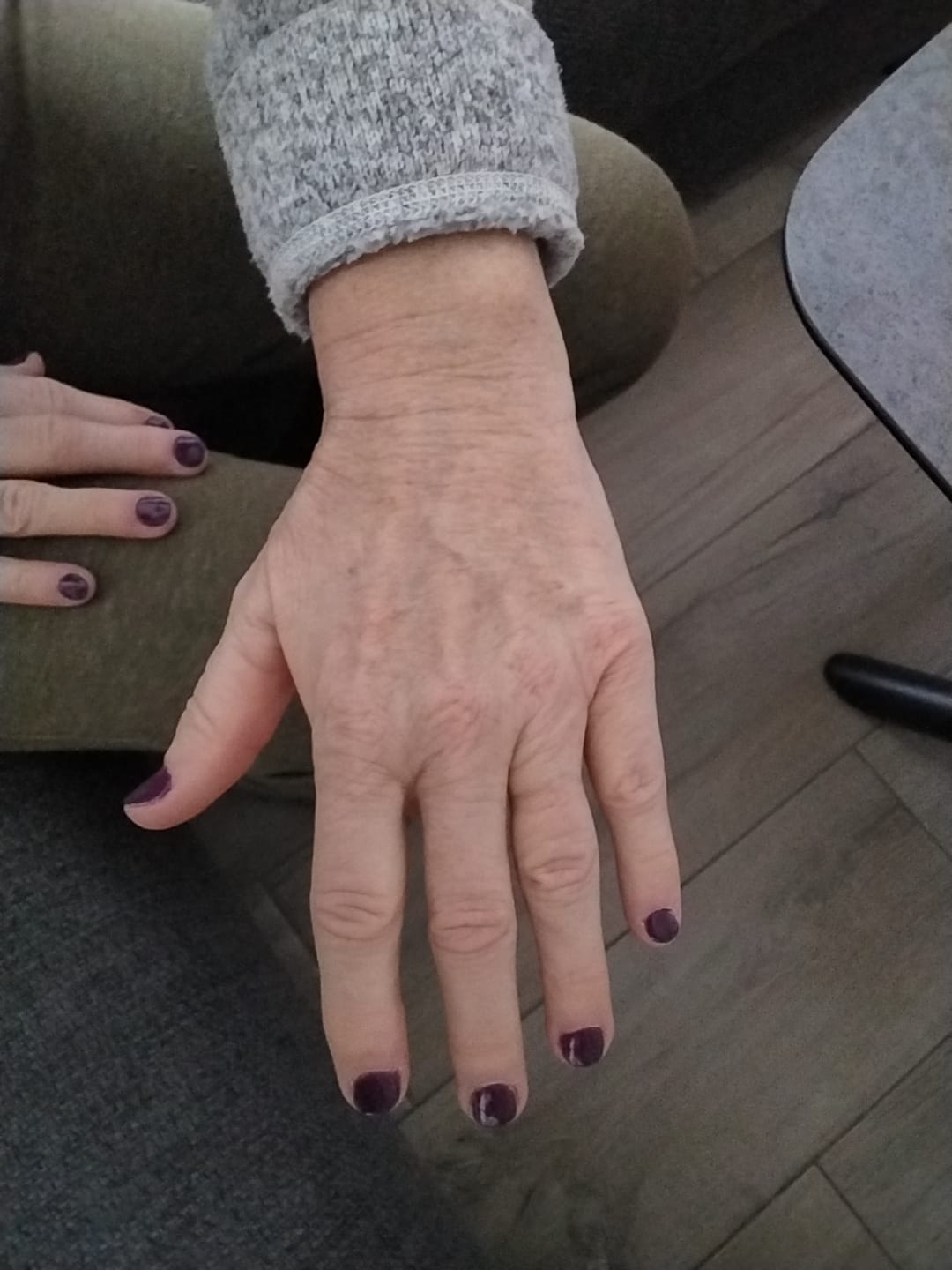 Customer photo review of Premium 4-In-1 Buffervijl (cadeau)