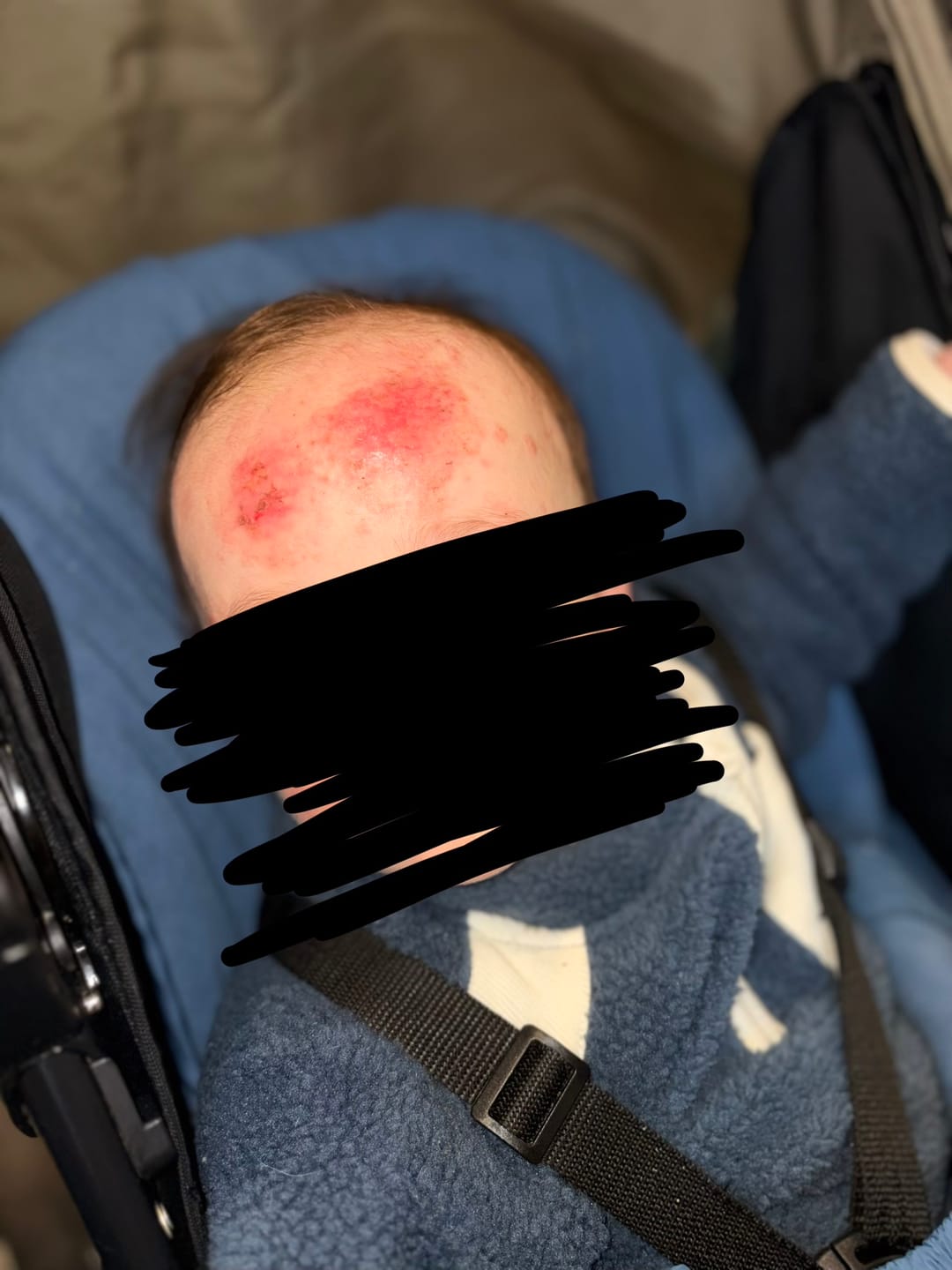 Customer photo review of Happy Skin Bundle