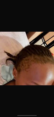 Customer photo review of Minoxidil REGULAR (2%) strength SOLUTION, 1 x 60ml pack