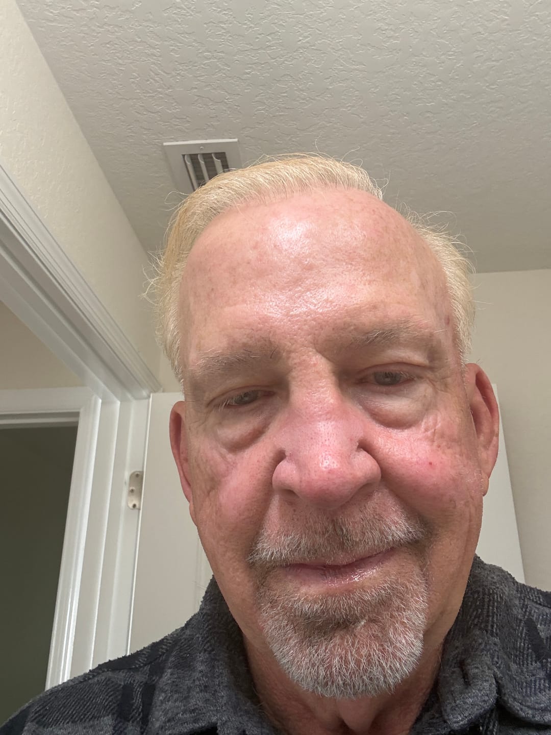 Customer photo review of Dr Melaxin Eye Cream