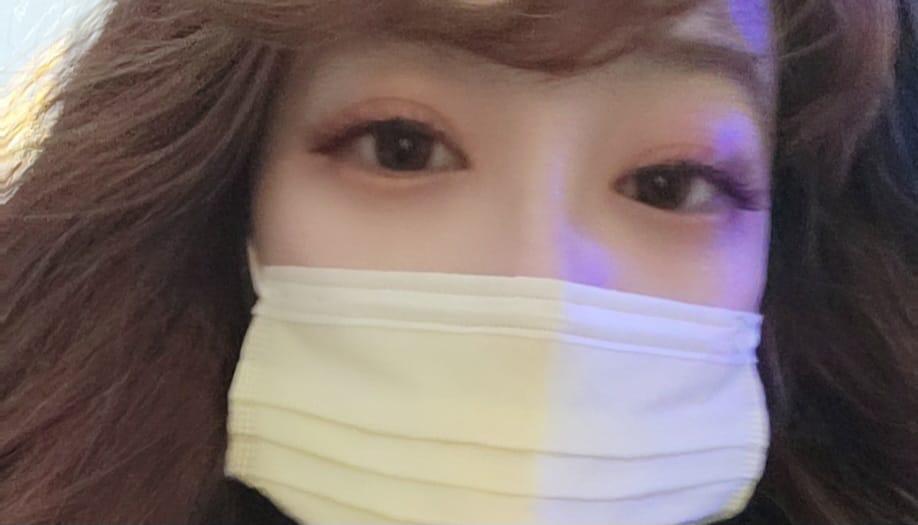 Customer photo review of NEO N314 高度數及遠視 年拋隱形眼鏡（1片）