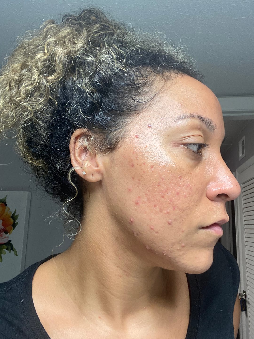 Customer photo review of Cassia Alata Leaf