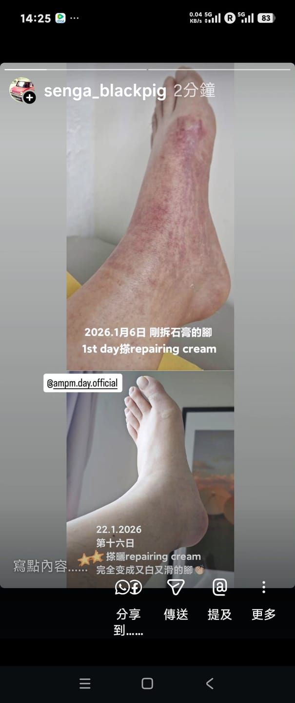 Customer photo review of PDRN Repairing Cream 50g