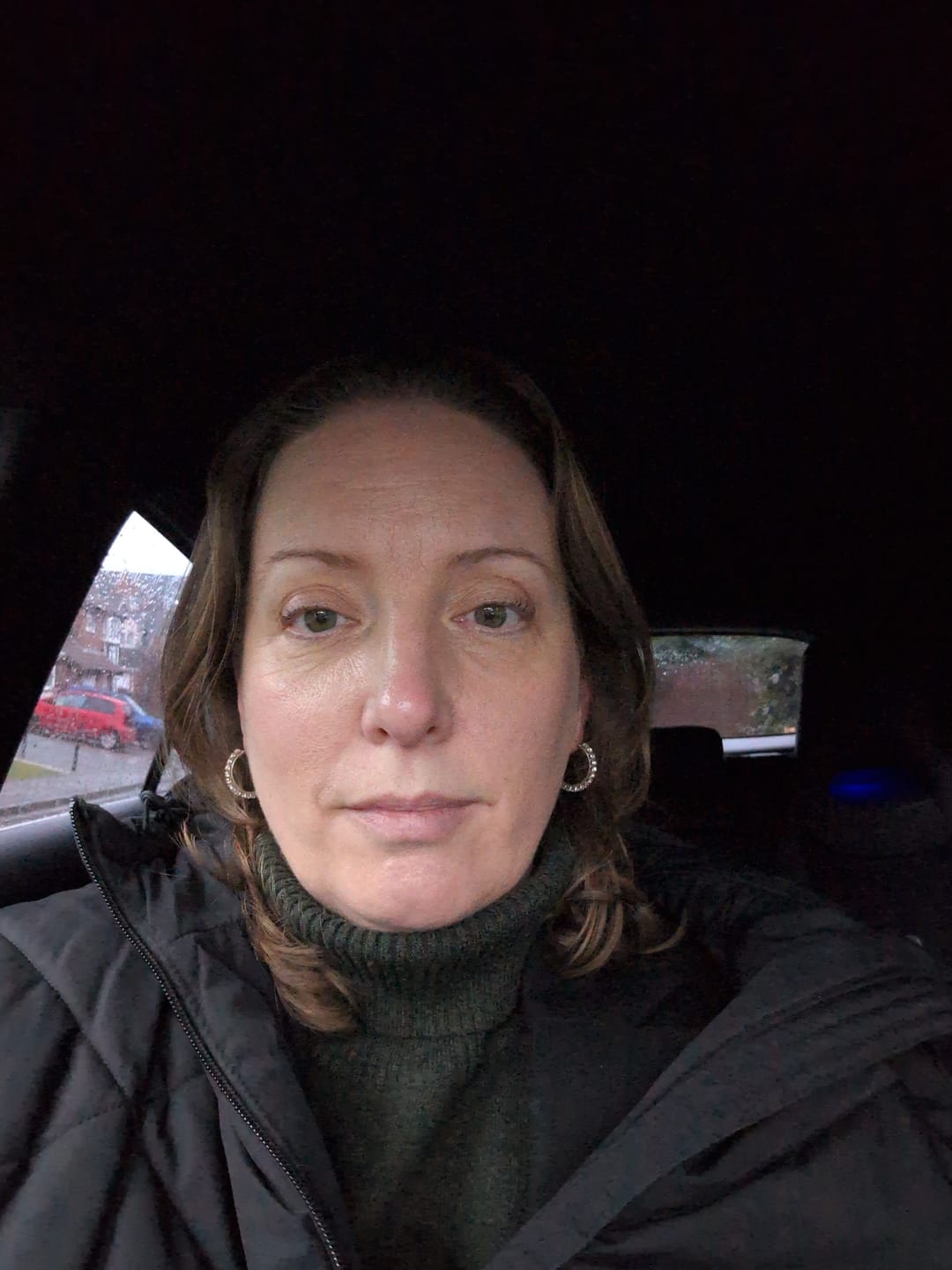 Customer photo review of Rosalique 3 in 1 Anti-Redness Miracle Formula SPF50