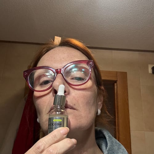 Customer photo review of Sérum de Exosomas Ultra Rejuvenecedor con Bioexosomas de Bakuchiol