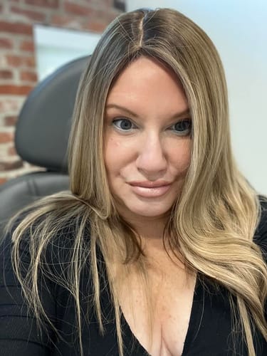 Customer photo review of EvenSkyn® Lumo⁺: Premium Anti-Aging & Skin Tightening Handset (2025)