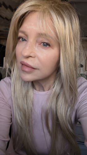 Customer photo review of EvenSkyn® Lumo⁺: Premium Anti-Aging & Skin Tightening Handset (2025)