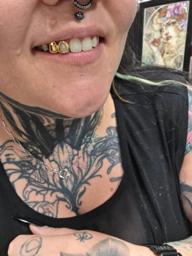 Customer photo review of PRISM (GOLD PLATED GRILLZ)