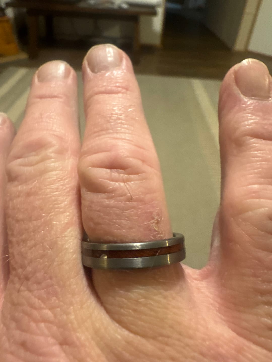 Customer photo review of Thorum Ring Sizer