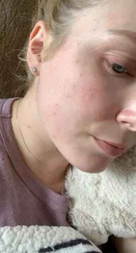 Customer photo review of Lumora™ GHK-Cu Copper Peptide Face Serum