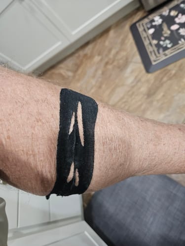 Customer photo review of Easy Kinesiology Tape (30-Day Supply)