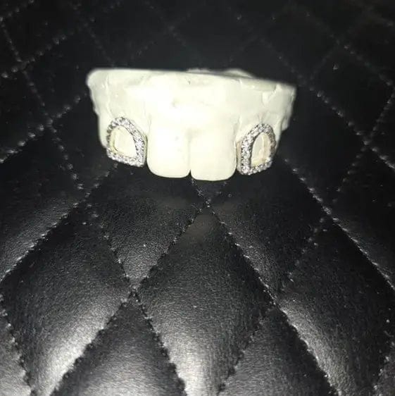 Customer photo review of （Full Refund For Grillz Made With This Brand）Impression Kit*1pcs