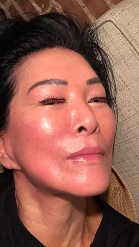 Customer photo review of Lumo⁺ + Venus: Comprehensive Anti-Aging Solution for Face and Eyes