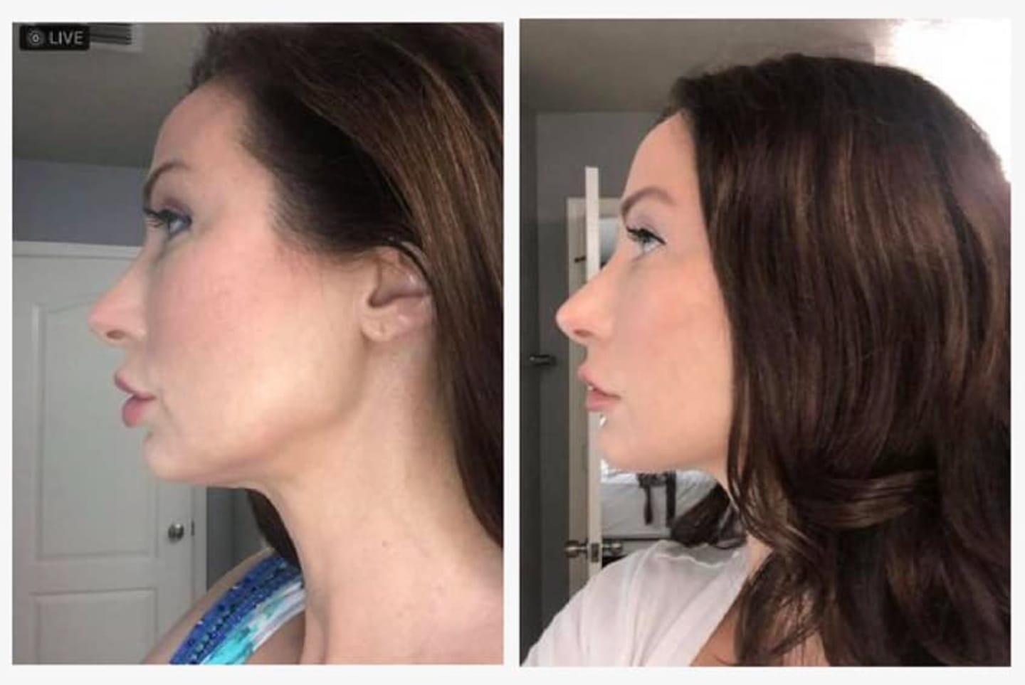 Customer photo review of Lumo⁺ + Venus + Phoenix: Ultimate Trio for Youthful and Radiant Skin