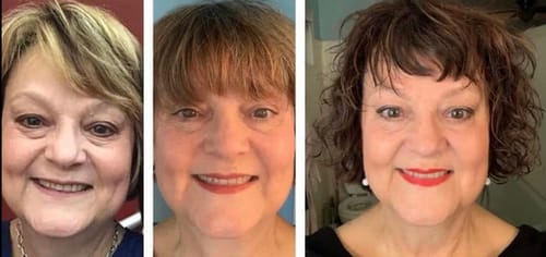 Customer photo review of Lumo⁺ + Venus: Comprehensive Anti-Aging Solution for Face and Eyes