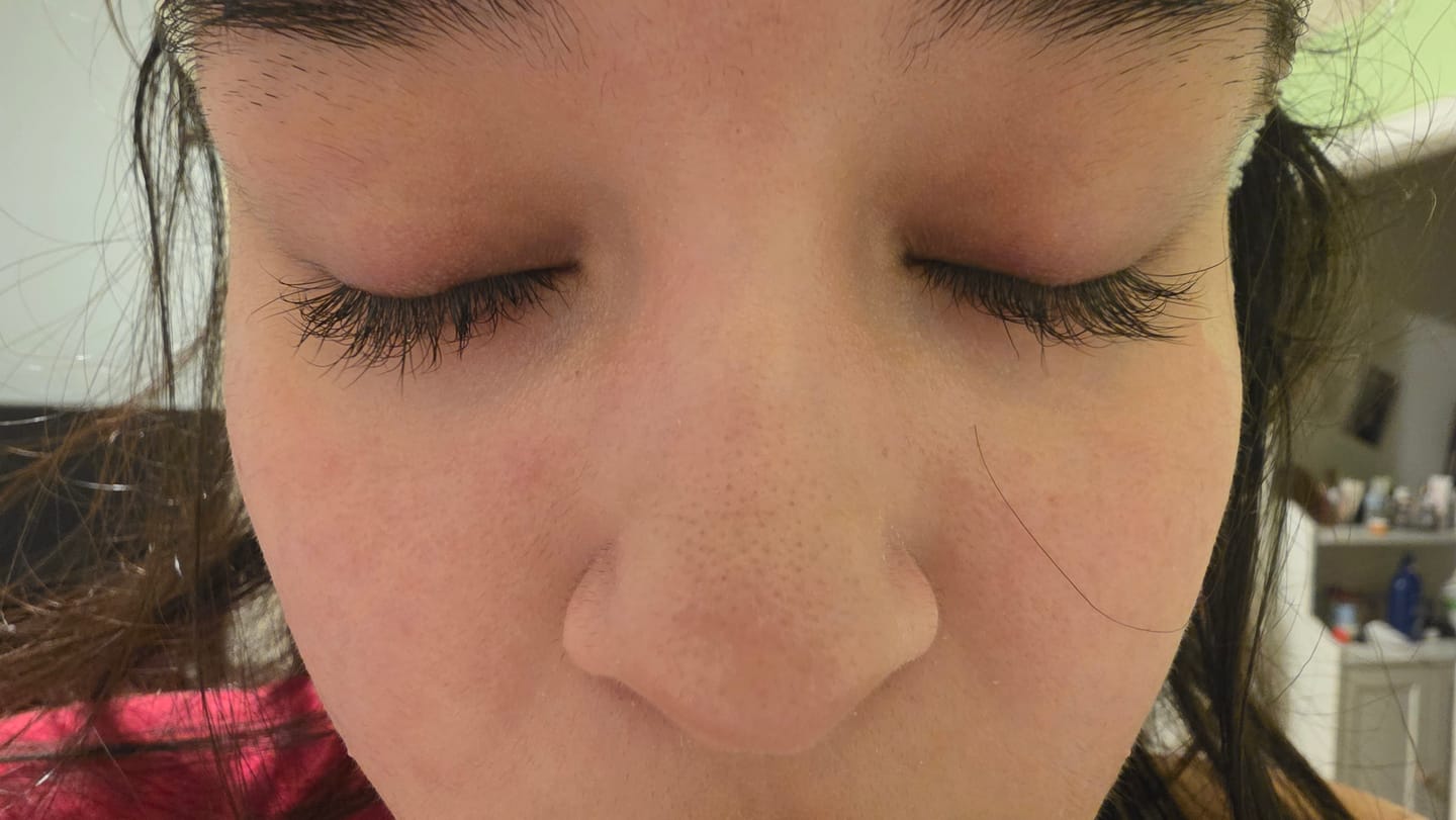 Customer photo review of fLASH EYELASH SERUM