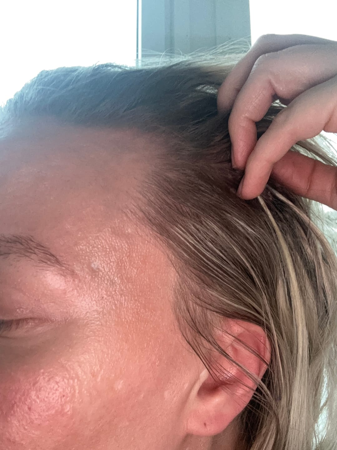 Customer photo review of Hair Loss Prevention Kit