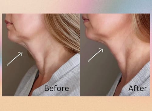 Customer photo review of Lumo⁺ + Venus: Comprehensive Anti-Aging Solution for Face and Eyes