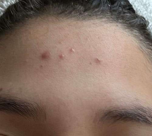 Customer photo review of Fresh Start 2X Hybrid Facial Cleanser