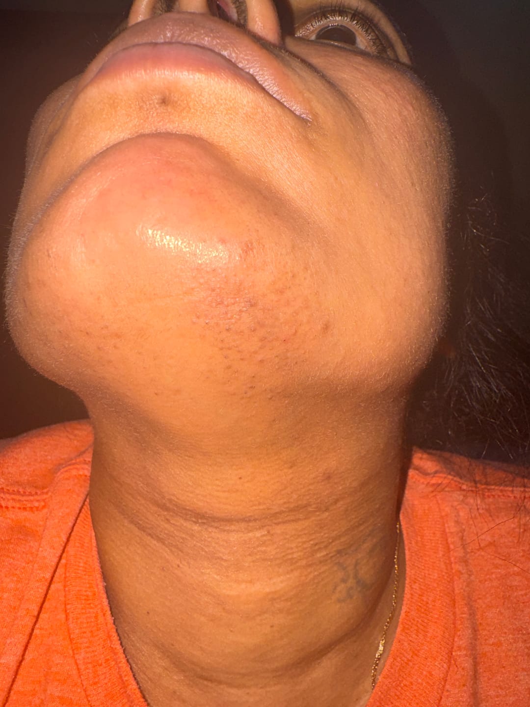Customer photo review of Hair Reducing Fade Oil - Slows Growth, Thins, and Reduces Hair Naturally