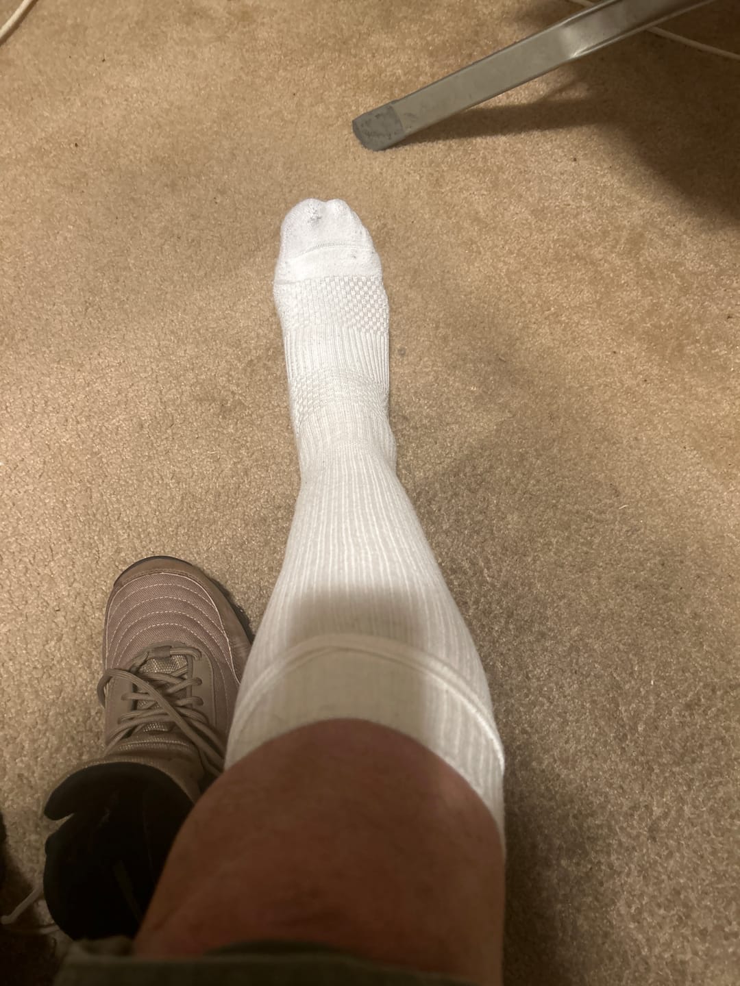 Customer photo review of Ankle Compression Buy 1 Get 2 Free Mystery Offer