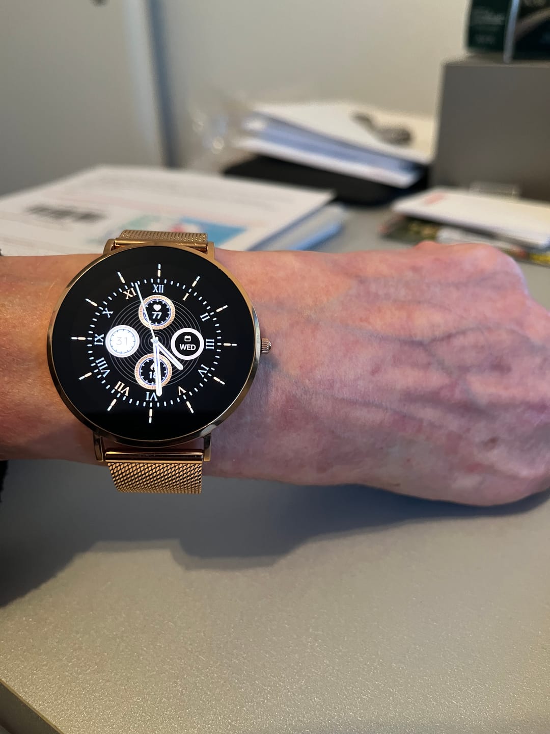 Customer photo review of Aurora™ Smartwatch