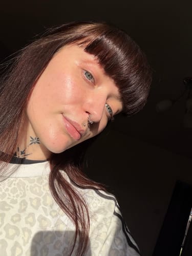 Customer showing their clear, soothed skin after using the Calm Skin-Relief Kit.