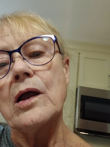 Close-up of a reviewer's face showing the results of using Grass Fed Tallow & Honey Balm.