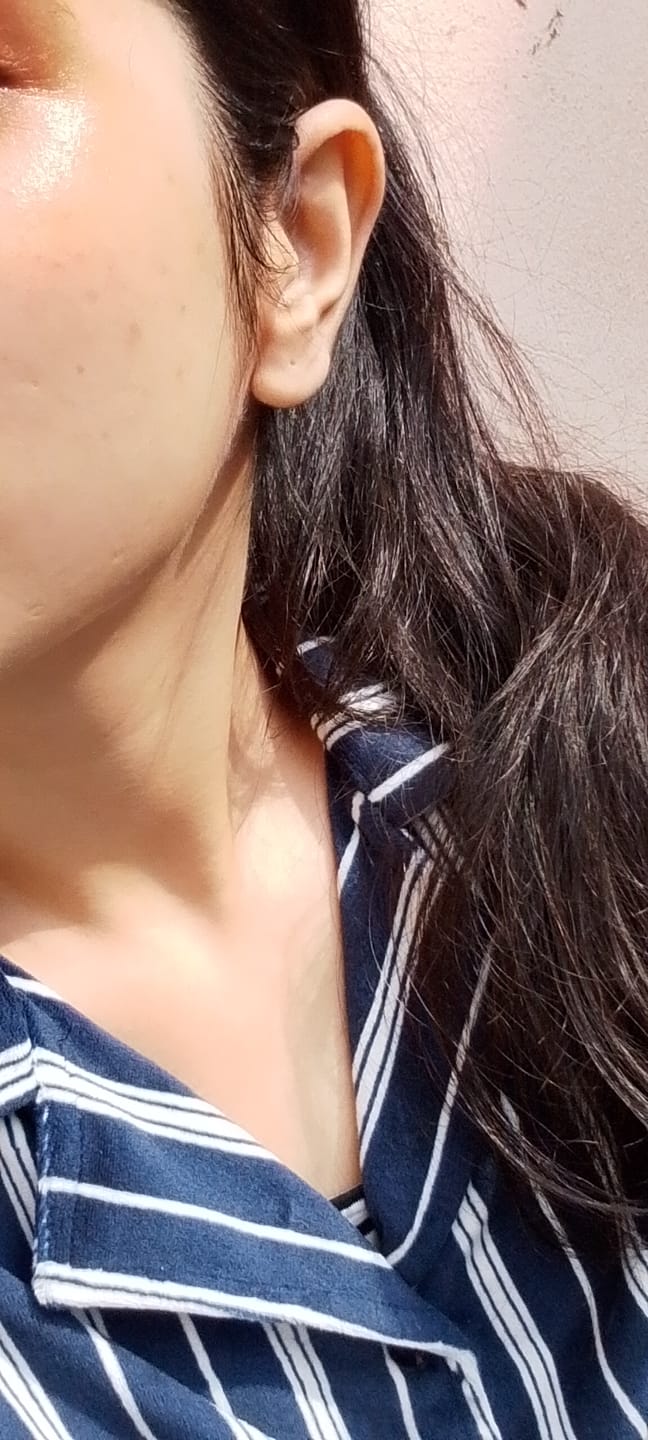 Customer photo review of Cerulic Glow Boosting Serum