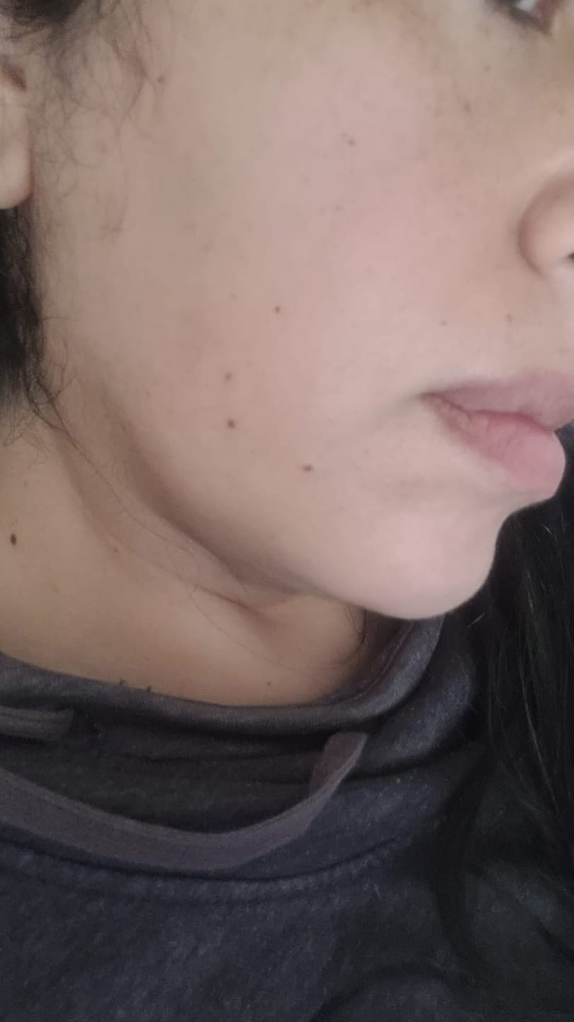 Customer photo review of Tónico Iluminador Aclarante
