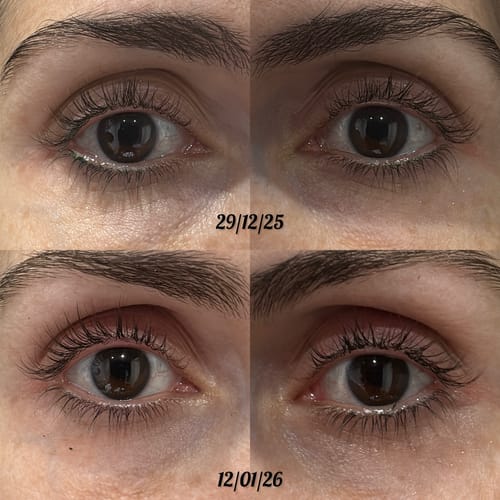 Customer photo review of KosmaLash® | Sérum Crecimiento & Anticaída